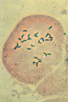 Chromosomes during meiotic division in Cryptocoryne beckettii
